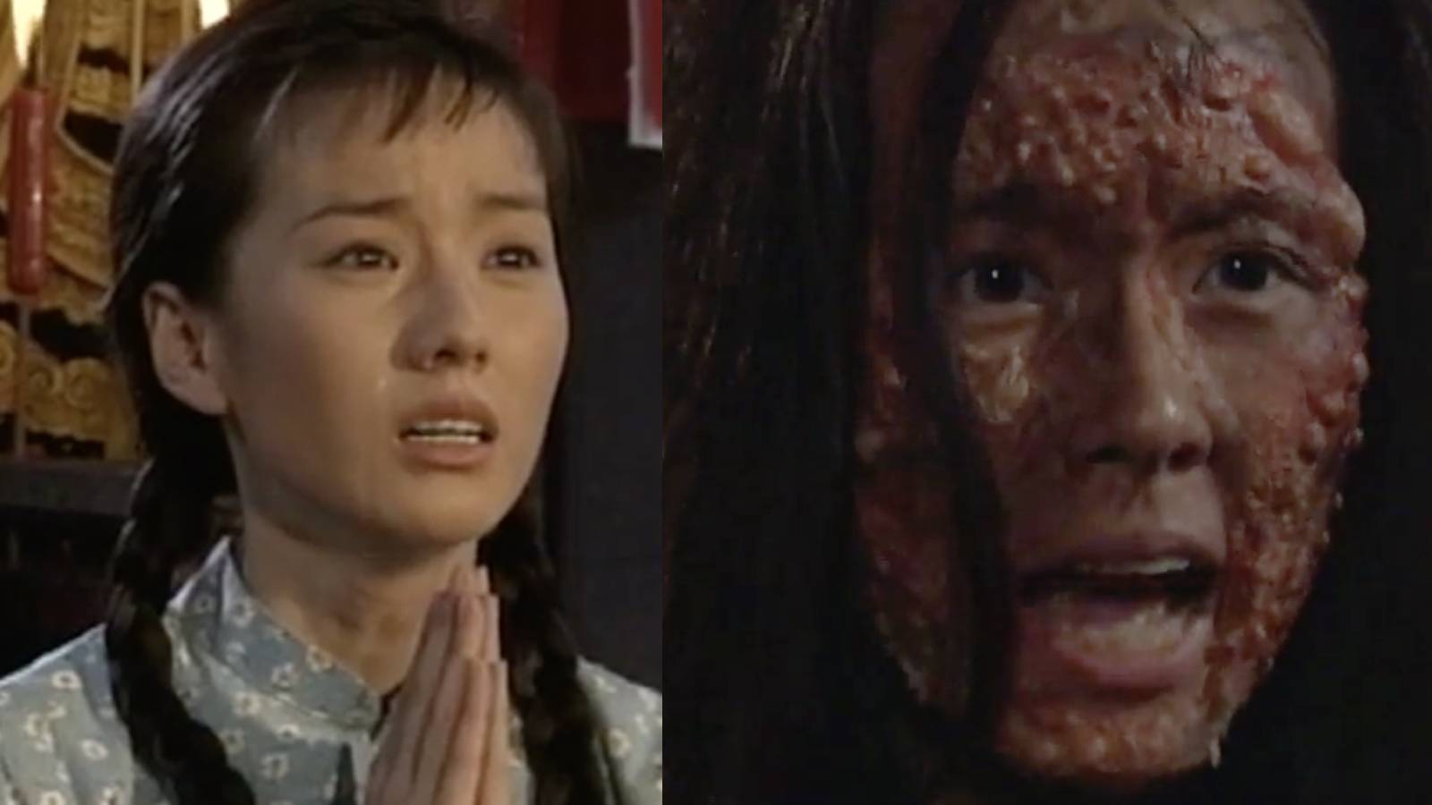 Yvonne in character as Hai Yan pre (left) and post skin disease