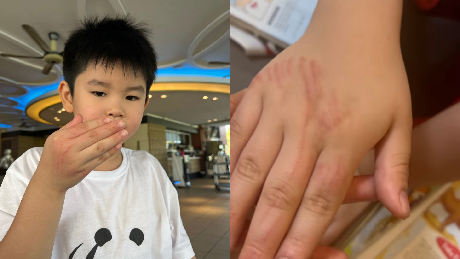 Fann Wong’s son got bitten by a fish