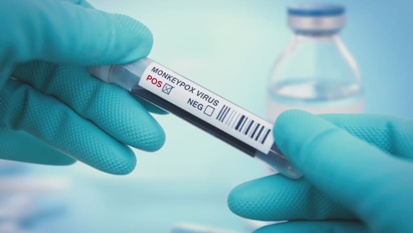 Singapore reports first local linked case of monkeypox; total of 15 infections confirmed since June Singapore reports first local linked case of monkeypox; total of 15 infections confirmed since June