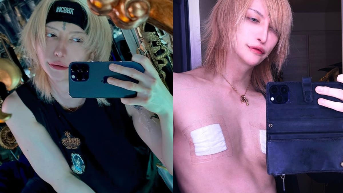Japanese guitarist has surgery to remove his nipples, says 'men don’t need them'