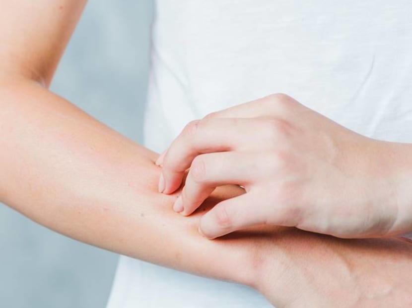 Unexplained rashes: Why do they occur and when should you see a doctor?
