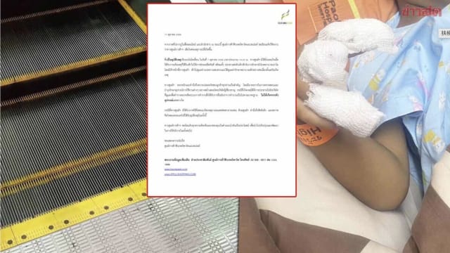 泰国商场恐怖事故 四岁童疑遭电动扶梯夹断手指