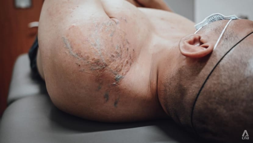 'I feel very fresh': The former gangsters in prison getting their tattoos removed for free 'I feel very fresh': The former gangsters in prison getting their tattoos removed for free