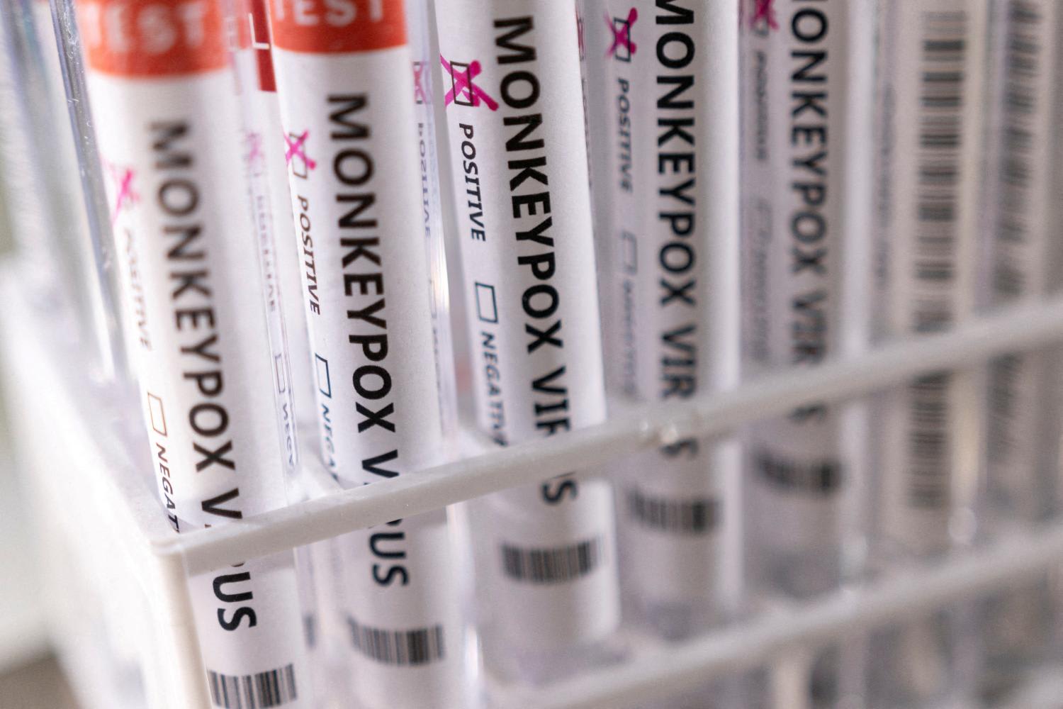 Monkeypox 'emergency' decision due from WHO sparks African criticism Monkeypox 'emergency' decision due from WHO sparks African criticism