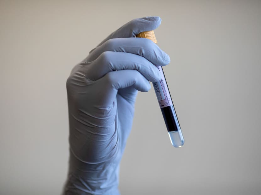 A blood sample is held during an antibody testing program in Birmingham, Britain.