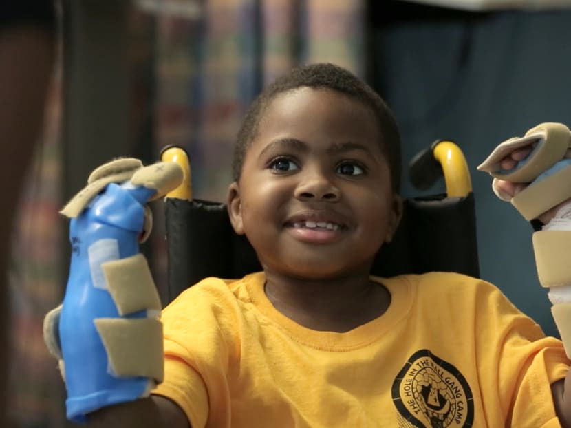 8-year-old Zion Harvey of Baltimore, Maryland posing with his newly transplanted hands. The first child in the world to undergo a double hand transplant is now able to write, feed and dress himself, doctors said on July 18, 2017, declaring the ground-breaking operation a success after 18 months. Photo: AFP
