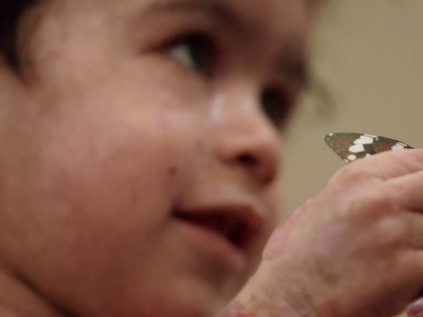 Singapore’s butterfly children, born with ‘the worst disease you’ve never heard of’ Singapore’s butterfly children, born with ‘the worst disease you’ve never heard of’