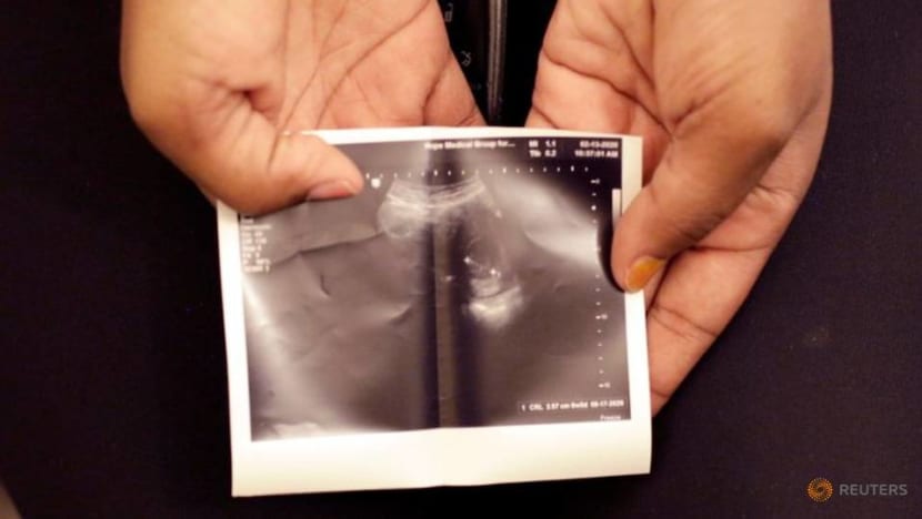 Texas city bans abortion, allows family to sue providers, helpers Texas city bans abortion, allows family to sue providers, helpers
