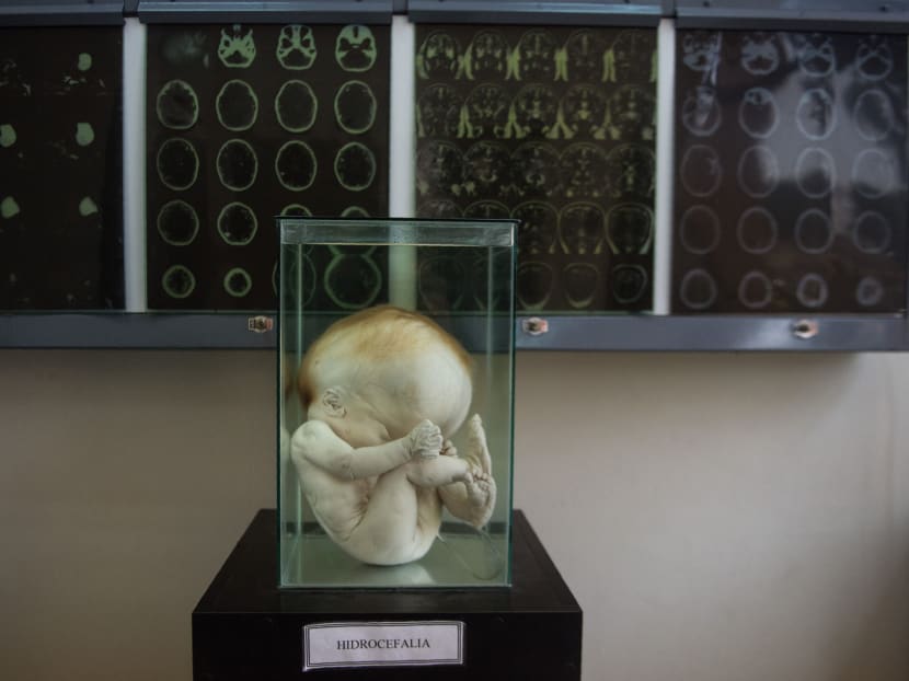 Gallery: Peru brain museum puts most complex organ on display
