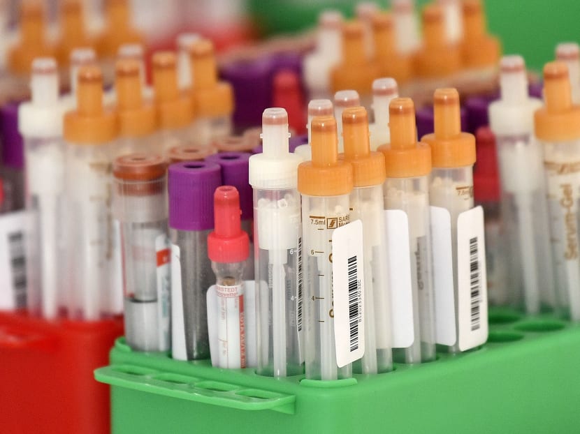 Samples for antibody tests against the new coronavirus are pictured on May 18, 2020 at the German Centre for Neurodegenerative Diseases (DZNE) in Bonn, Germany.