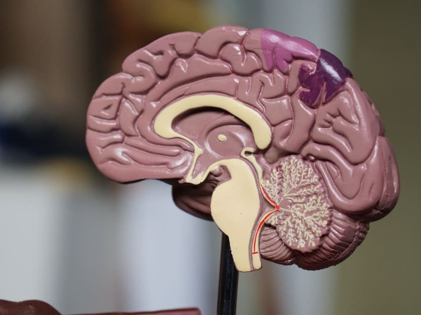 Some coronavirus patients show signs of brain ailments
