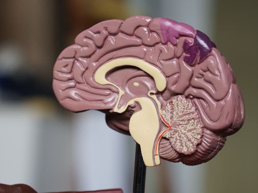 Some coronavirus patients show signs of brain ailments Some coronavirus patients show signs of brain ailments
