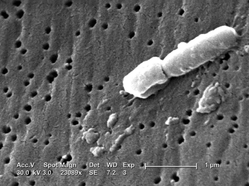A Klebsiella pneumoniae bacterium under a scanning electron microscope. Source: Centres for Disease Control and Prevention via Bloomberg