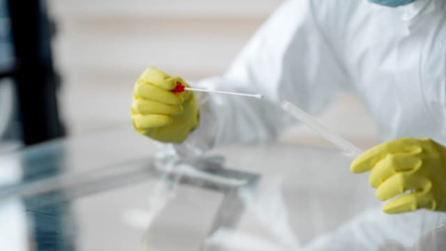 中国放宽防疫措施 本地诊所核酸检测需求预计会增加