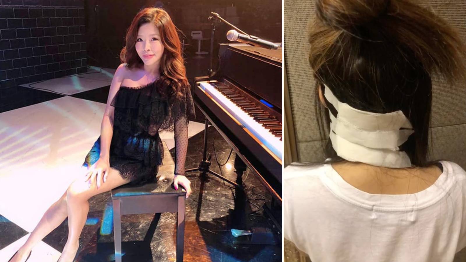 Taiwanese Singer Angie Lee Slipped And Hit Her Head In Her Bathroom After Taking A Shower Post-Workout Taiwanese Singer Angie Lee Slipped And Hit Her Head In Her Bathroom After Taking A Shower Post-Workout