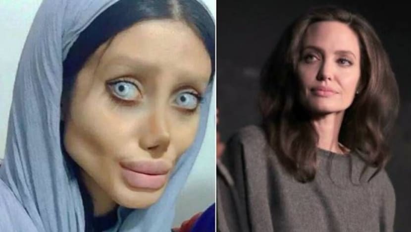 Belia Iran ini sanggup lakukan 50 pembedahan untuk dapat wajah mirip Angelina Jolie