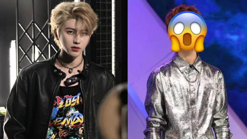 Chinese Idol Cai Xukun’s Ex Company Says They Spent Over S$150K On Plastic Surgery For Their Trainees, Posts Old Pics Of The Singer To Prove Their Point