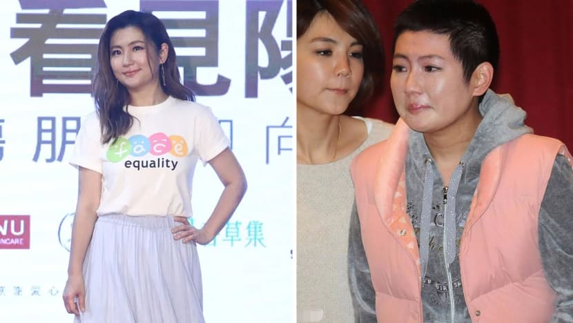 Selina Jen Says Undergoing Rehab After Her 2010 Burn Accident Was Like “Going To Jail”