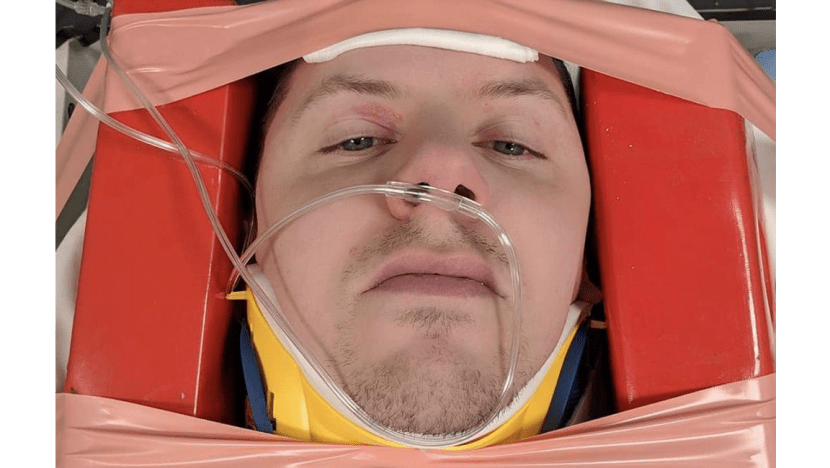 Professor Green fractures neck Professor Green fractures neck