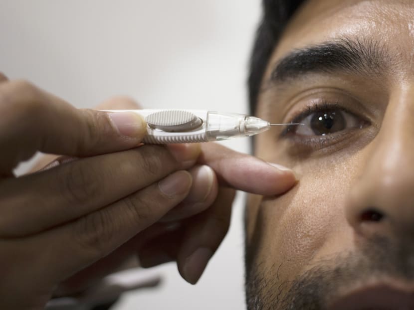 The Singapore National Eye Centre is calling for about 120 volunteers to participate in a two-year trial on a new glaucoma treatment that will involve an injection into the inner eye. Photo: Wong Pei Ting