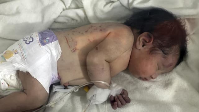 叙利亚新生女婴地震废墟中获救 发现时脐带仍与母亲相连