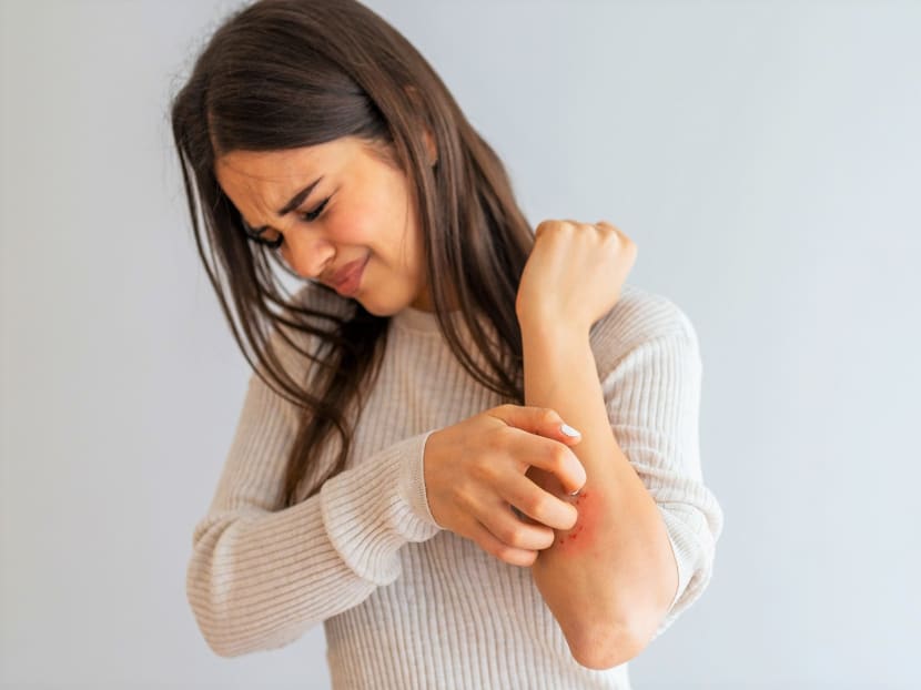 Eczema is a long-term skin condition that can be successfully managed with constant and consistent care. Images: Shutterstock, Ceradan Eczema is a long-term skin condition that can be successfully managed with constant and consistent care. Images: Shutterstock, Ceradan