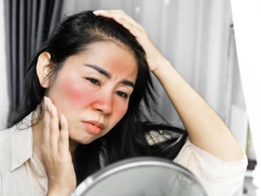 Do you get itchy, swollen, red rashes when you’re outside? You may have a case of 'sun allergy'