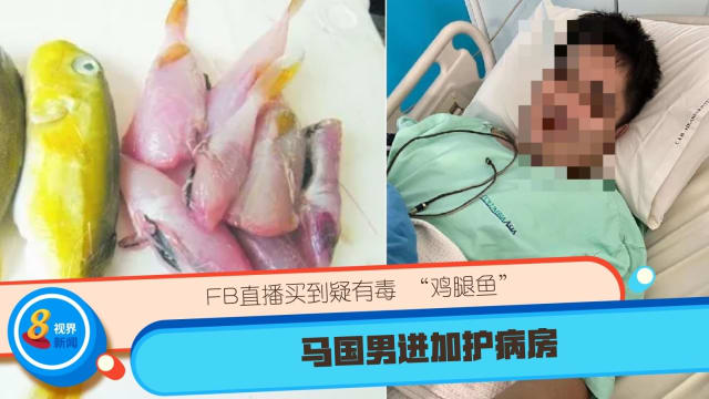 FB直播买到疑有毒“鸡腿鱼” 马国男进加护病房