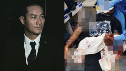 HK Actor Jason Wong, Who Is Often Called A “Louis Koo Knockoff”, Gets 100 Stitches On Face After Getting Attacked In Restaurant