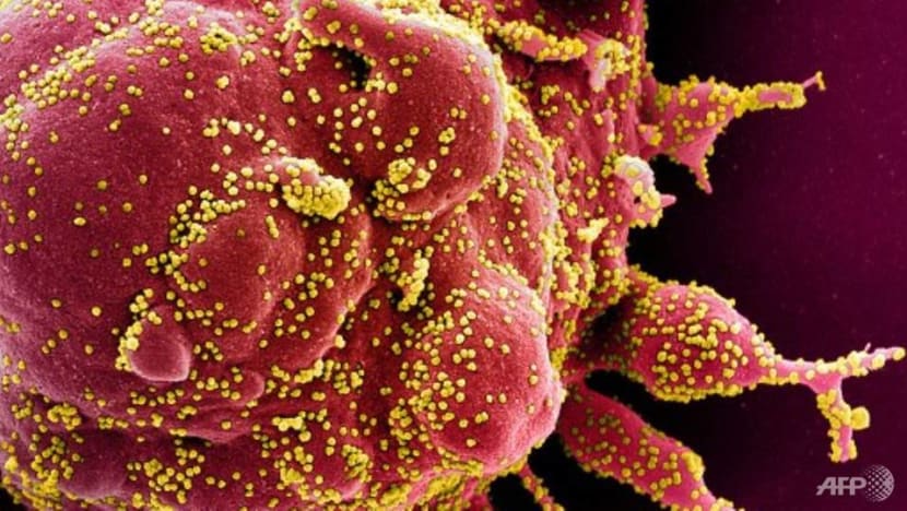 COVID-19 patients can 'shed high load of virus' in first week, irrespective of symptoms: Singapore study COVID-19 patients can 'shed high load of virus' in first week, irrespective of symptoms: Singapore study