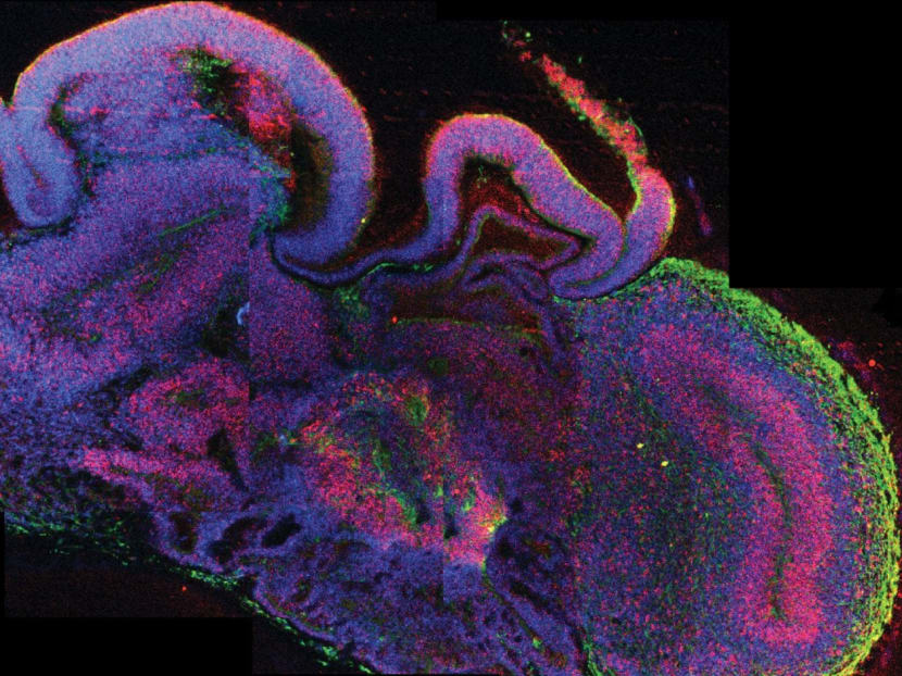A greatly enlarged image showing a cross-section of a brain organoid.