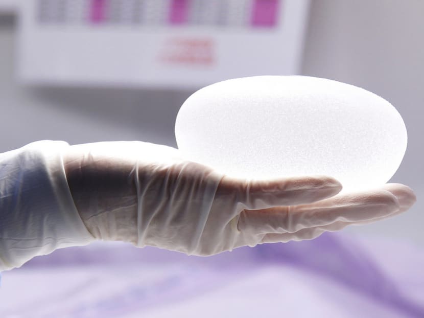 In the past, more than 90 per cent of breast augmentations were carried out with silicone implants. However, according to Dr Leo Kah Woon, this percentage is dropping among Singaporeans as more people gravitate towards fat grafting procedure. PHOTO: REUTERS