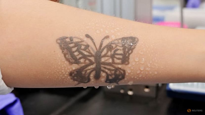 South Korea develops nanotech tattoo as health monitoring device South Korea develops nanotech tattoo as health monitoring device