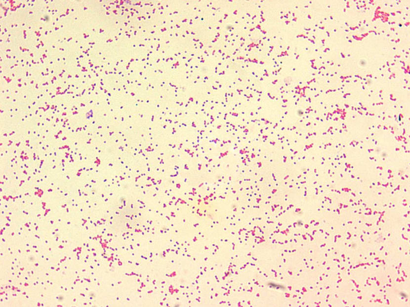 Health officials in Lanzhou city said 3,245 people had contracted brucellosis, a disease often caused by close contact with infected animals or animal products that can bring about fevers, joint pain and headaches. Health officials in Lanzhou city said 3,245 people had contracted brucellosis, a disease often caused by close contact with infected animals or animal products that can bring about fevers, joint pain and headaches.