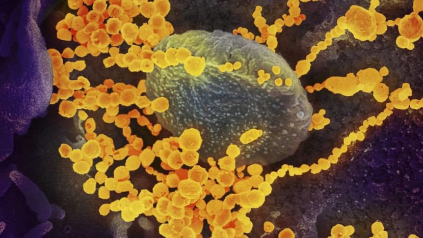 People with COVID-19 are ‘most infectious’ in first 7 days after developing symptoms: NCID consultant People with COVID-19 are ‘most infectious’ in first 7 days after developing symptoms: NCID consultant
