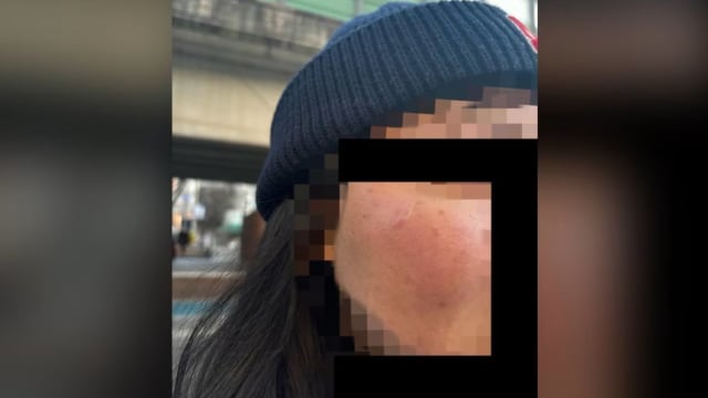 当街拳殴狮城女留学生 韩国男子被逮捕