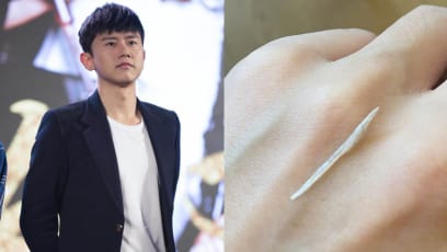 Chinese Singer Zhang Jie Rushed To The Hospital After Swallowing Fish Bone; Has A Fear Of Eating Fish Now