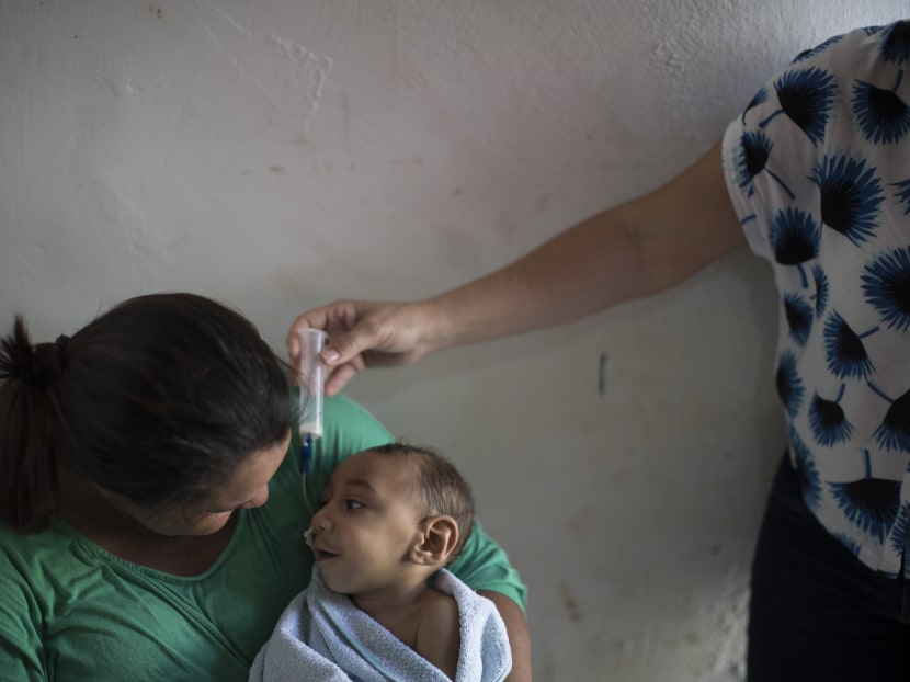 In this Sept. 27, 2016 photo, Solange Ferreira holds her son Jose Wesley Campos as family friend Sandra Souza, right, holds his nasogastric feeding tube during his 1-year birthday party at his home in Bonito, Pernambuco state, Brazil. Learning how to feed is the Jose’s latest struggle as medical problems mount for him and many other infants born with small heads to mothers infected with the Zika virus in Brazil. Photo: AP