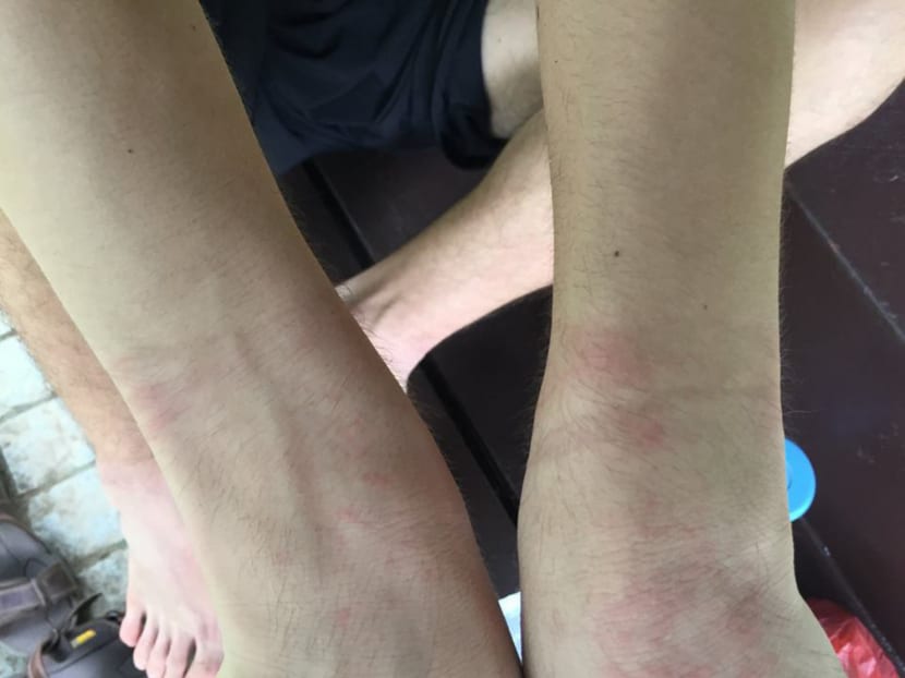 Sebastien’s wrists showing lingering redness after he was handcuffed by the police. His mother said the decision to grab her son was ‘completely out of line’. Photo: Choo Kah Ying’s Facebook page Sebastien’s wrists showing lingering redness after he was handcuffed by the police. His mother said the decision to grab her son was ‘completely out of line’. Photo: Choo Kah Ying’s Facebook page