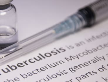 "In Singapore’s path to TB elimination, it is incumbent on us to become progressively more people-centred and reduce the barriers to TB diagnosis and treatment," said the authors.