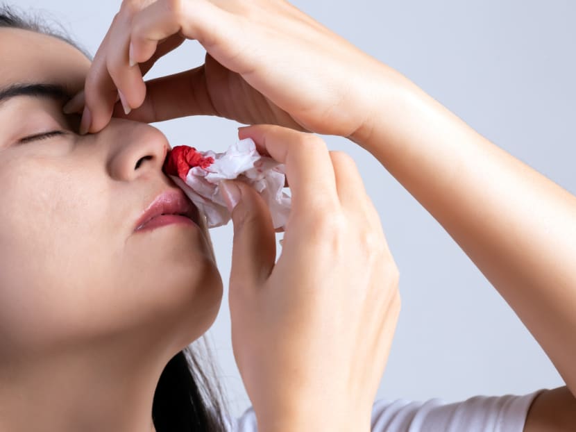 What causes nosebleeds? When should you check for signs of cancer?