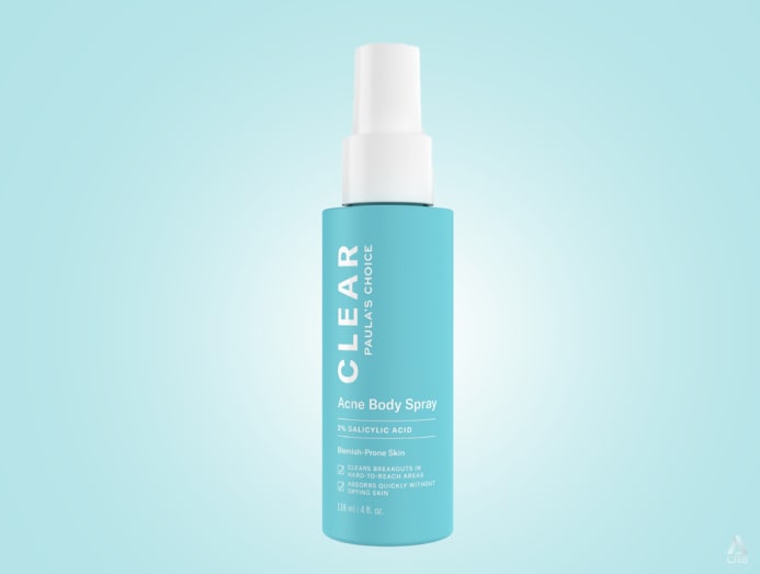 Body and back acne: What causes it and how to treat it - CNA Lifestyle