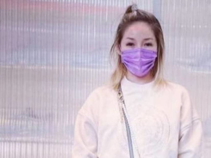Taiwanese star Elva Hsiao reveals extent of facial scar caused by dog bite