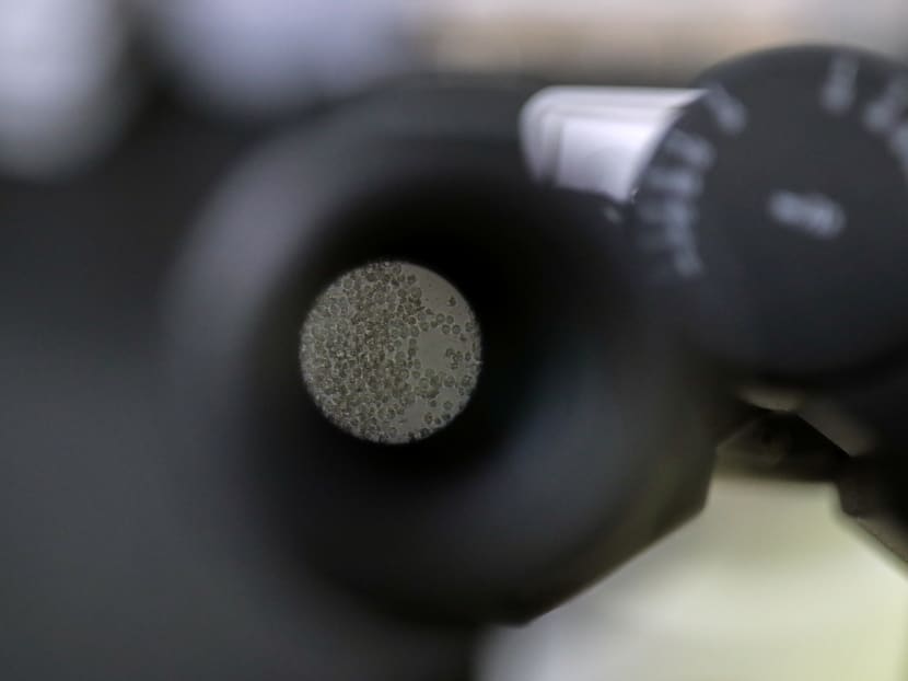 Cells that produce antibodies against Covid-19 are seen through a microscope in a university lab in Athens, Greece, on July 8, 2020. Cells that produce antibodies against Covid-19 are seen through a microscope in a university lab in Athens, Greece, on July 8, 2020.