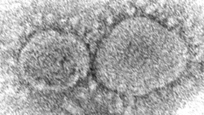Coronavirus origins still a mystery 3 years into COVID-19 pandemic