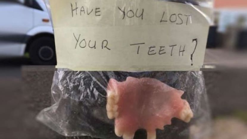Ada sesiapa hilang gigi palsu?