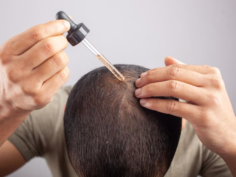 Minoxidil for hair loss: What you need to about this widely drug to restore growth - CNA Lifestyle