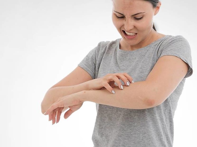 How to deal with eczema if wearing masks and washing hands make you itch
