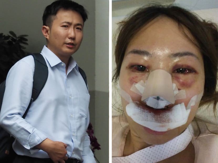 Accused of bashing girlfriend, doctor claims his alcoholism causes blackouts and he doesn’t recall assault Accused of bashing girlfriend, doctor claims his alcoholism causes blackouts and he doesn’t recall assault