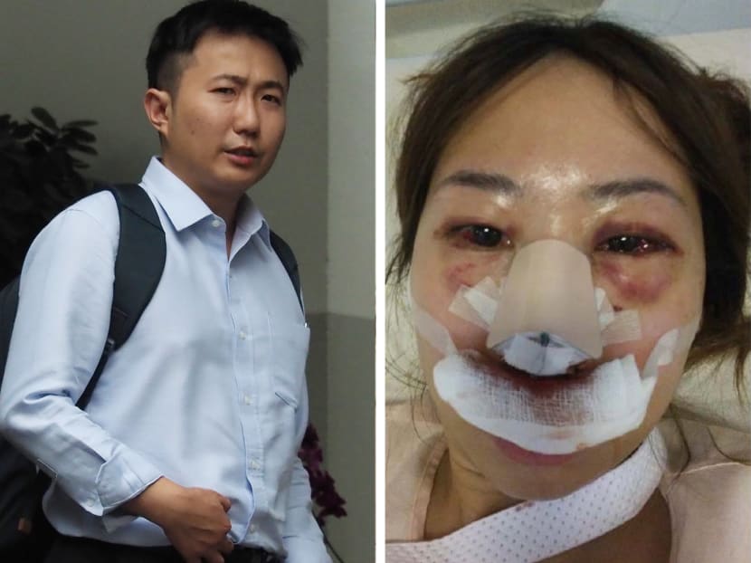 Clarence Teo Shun Jie is accused of brutally assaulting his then-girlfriend Rachel Lim in 2017 after she refused him sex.